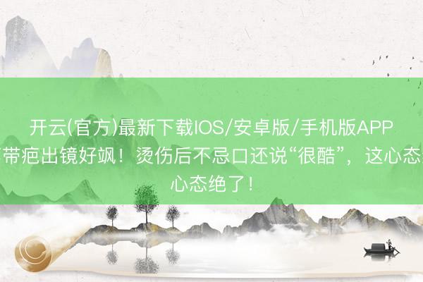 开云(官方)最新下载IOS/安卓版/手机版APP 杨蓉带疤出镜好飒！烫伤后不忌口还说“很酷”，这心态绝了！