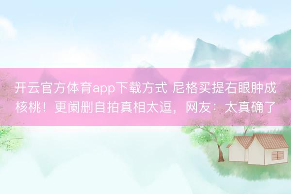 开云官方体育app下载方式 尼格买提右眼肿成核桃！更阑删自拍真相太逗，网友：太真确了