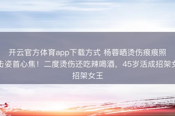 开云官方体育app下载方式 杨蓉晒烫伤痕痕照反击姿首心焦！二度烫伤还吃辣喝酒，45岁活成招架女王