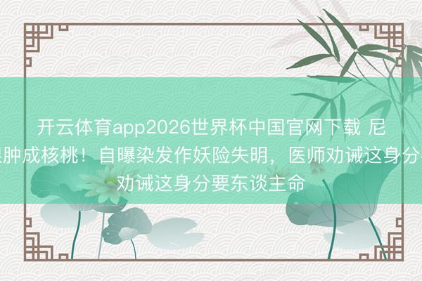 开云体育app2026世界杯中国官网下载 尼格买提右眼肿成核桃！自曝染发作妖险失明，医师劝诫这身分要东谈主命